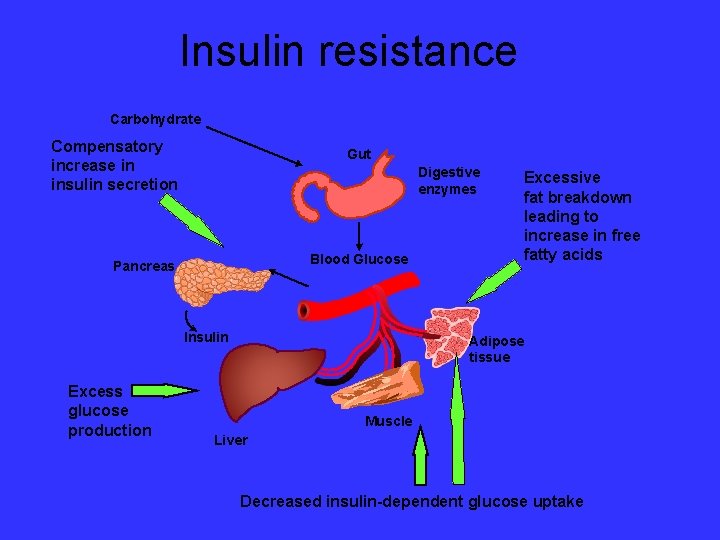 2-es típusú cukorbetegség (nem inzulinfüggő diabétesz) jellemzői