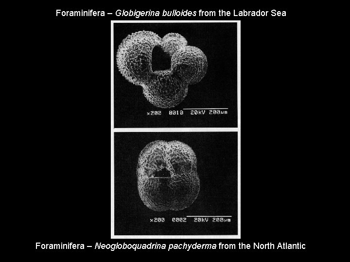 Foraminifera – Globigerina bulloides from the Labrador Sea Foraminifera – Neogloboquadrina pachyderma from the