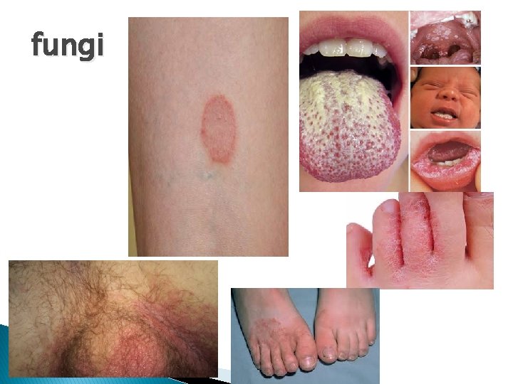 fungi fungi