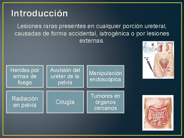 Introducción Lesiones raras presentes en cualquier porción ureteral, causadas de forma accidental, iatrogénica o