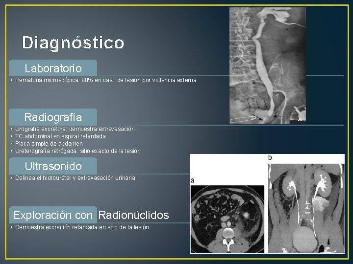 Diagnóstico Laboratorio • Hematuria microscópica: 90% en caso de lesión por violencia externa Radiografía