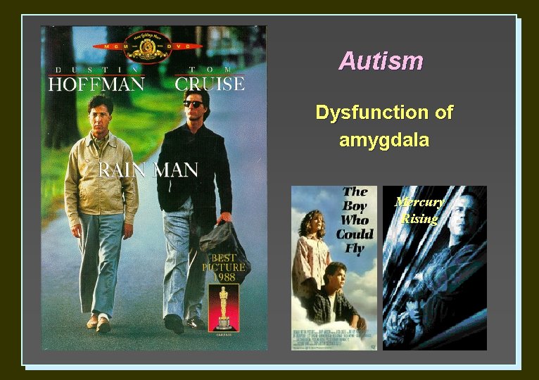 Autism Dysfunction of amygdala Mercury Rising 