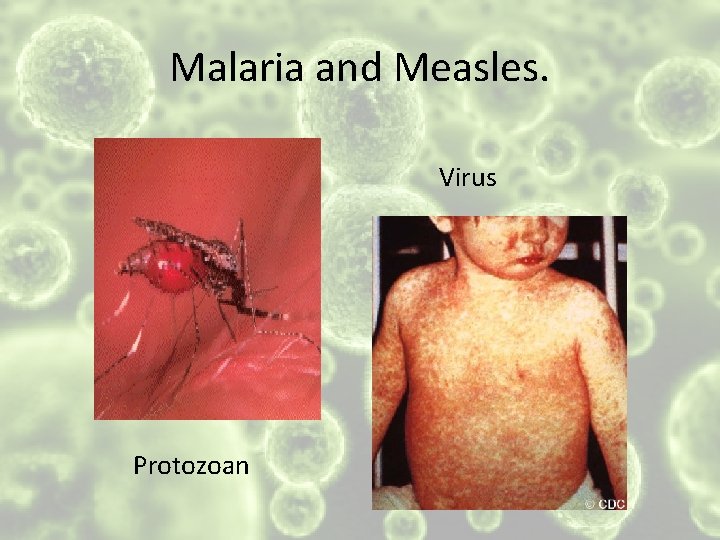 Malaria and Measles. Virus Protozoan 