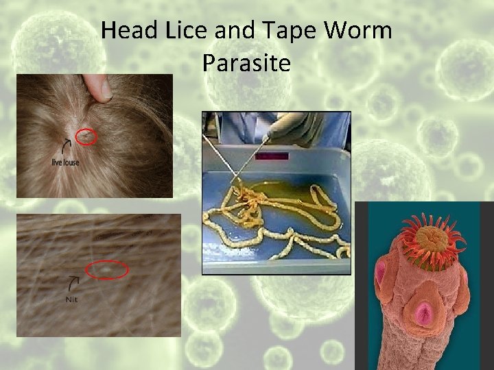 Head Lice and Tape Worm Parasite 