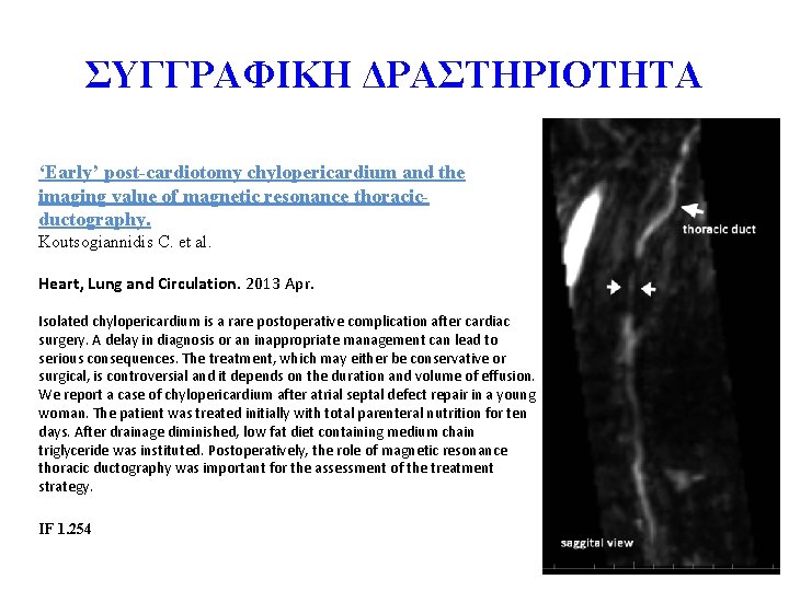 ΣΥΓΓΡΑΦΙΚΗ ΔΡΑΣΤΗΡΙΟΤΗΤΑ ‘Early’ post-cardiotomy chylopericardium and the imaging value of magnetic resonance thoracicductography. Koutsogiannidis