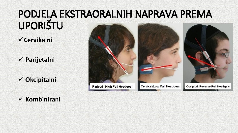 PODJELA EKSTRAORALNIH NAPRAVA PREMA UPORIŠTU üCervikalni ü Parijetalni ü Okcipitalni ü Kombinirani 