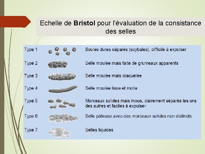 Echelle de Bristol pour l’évaluation de la consistance des selles 