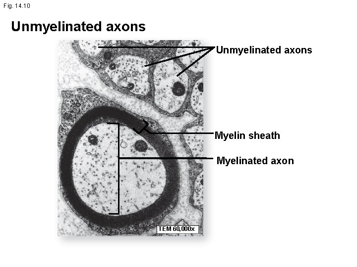 Fig. 14. 10 Unmyelinated axons Myelin sheath Myelinated axon TEM 60, 000 x 