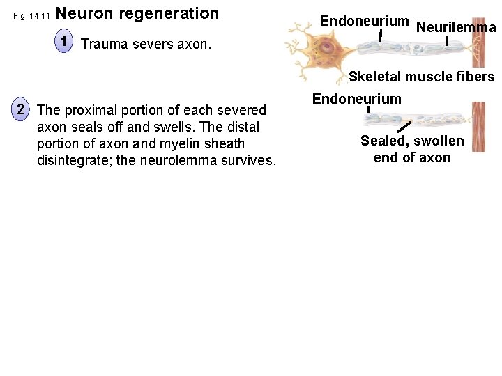 Fig. 14. 11 Neuron regeneration 1 Trauma severs axon. Endoneurium Neurilemma Skeletal muscle fibers