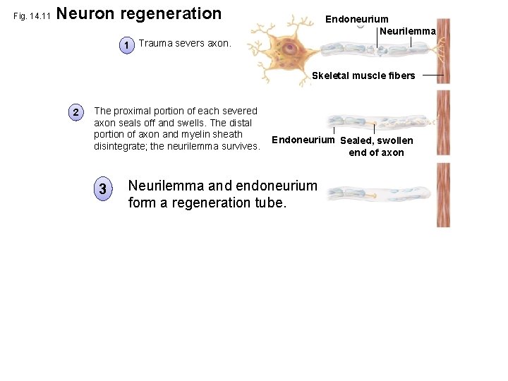 Fig. 14. 11 Neuron regeneration Endoneurium Neurilemma 1 Trauma severs axon. Skeletal muscle fibers