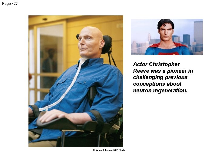 Page 427 Actor Christopher Reeve was a pioneer in challenging previous conceptions about neuron