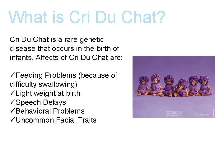What is Cri Du Chat? Cri Du Chat is a rare genetic disease that