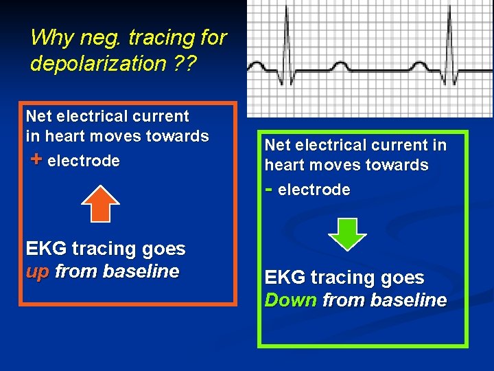 Why neg. tracing for depolarization ? ? Net electrical current in heart moves towards