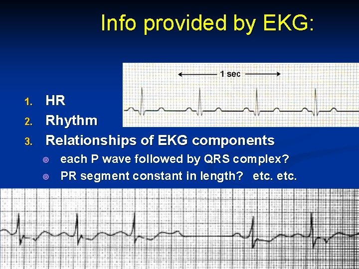 Info provided by EKG: 1. 2. 3. HR Rhythm Relationships of EKG components each