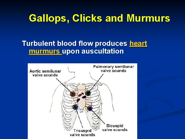 Gallops, Clicks and Murmurs Turbulent blood flow produces heart murmurs upon auscultation 