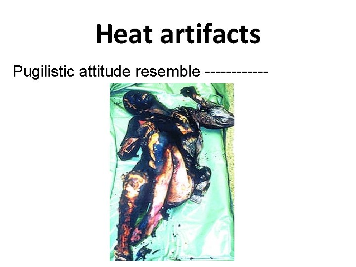 Heat artifacts Pugilistic attitude resemble ------ 