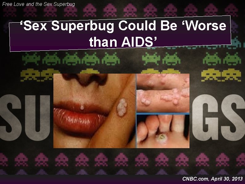Free Love and the Sex Superbug ‘Sex Superbug Could Be ‘Worse than AIDS’ CNBC.