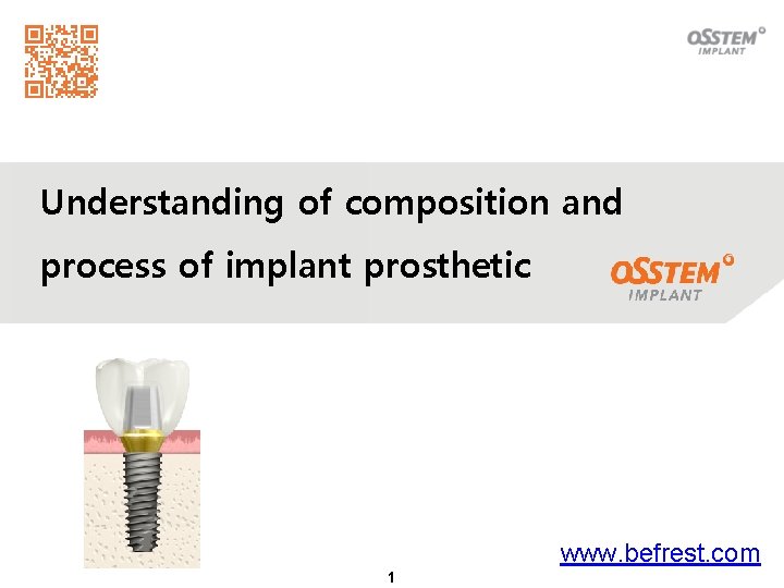 Understanding of composition and process of implant prosthetic www. befrest. com 1 