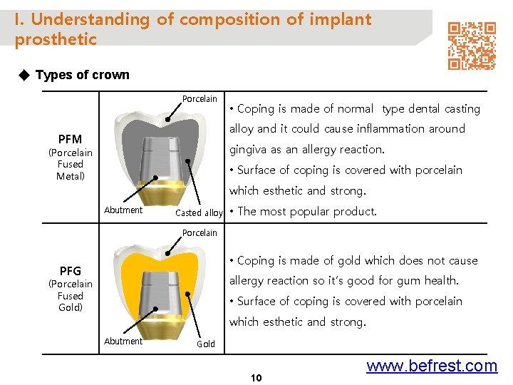 I. Understanding of composition of implant prosthetic ◆ Types of crown Porcelain • Coping