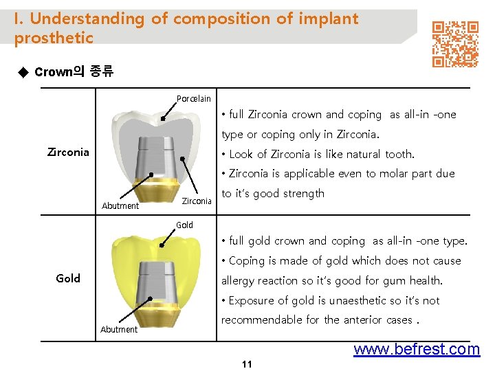 I. Understanding of composition of implant prosthetic ◆ Crown의 종류 Porcelain • full Zirconia