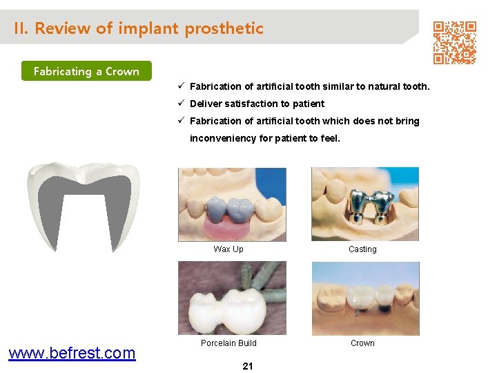 II. Review of implant prosthetic Fabricating a Crown ü Fabrication of artificial tooth similar