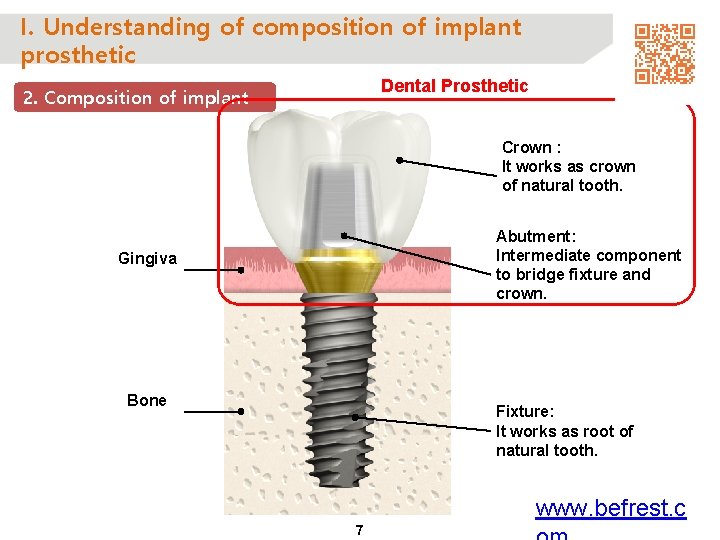 I. Understanding of composition of implant prosthetic Dental Prosthetic 2. Composition of implant Crown