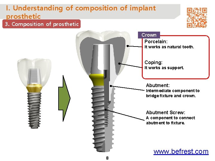 I. Understanding of composition of implant prosthetic 3. Composition of prosthetic Crown Porcelain: It