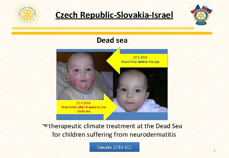 Czech Republic-Slovakia-Israel Dead sea 22. 5. 2004 Maximilian before therapy 22. 6. 2004 Maximilian