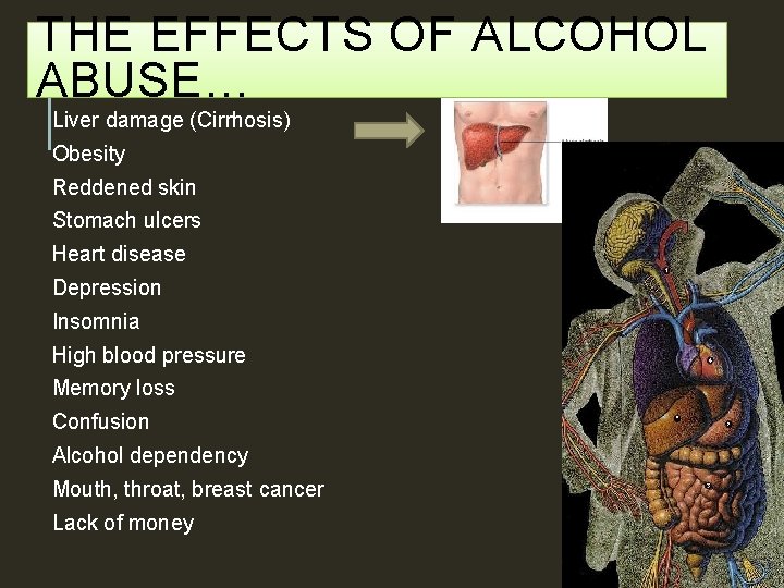 THE EFFECTS OF ALCOHOL ABUSE… Liver damage (Cirrhosis) Obesity Reddened skin Stomach ulcers Heart