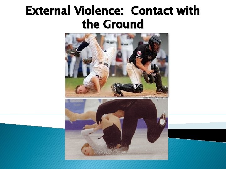Sports Injuries and Prevention Injuries Are Common Almost