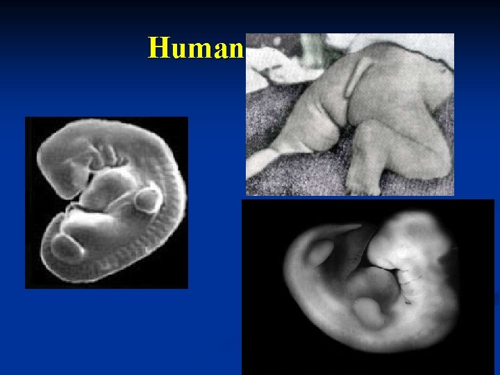 Human embryo 