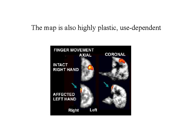 The map is also highly plastic, use-dependent 