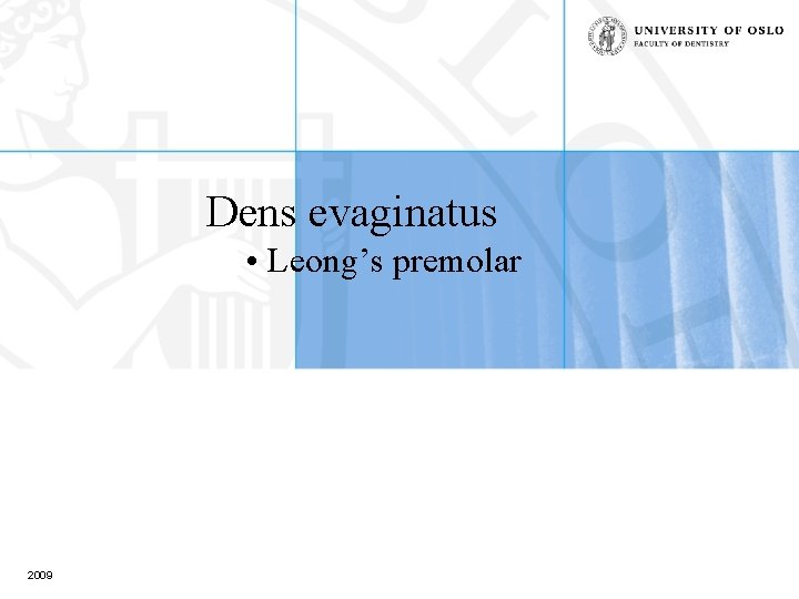 Dens evaginatus • Leong’s premolar 2009 