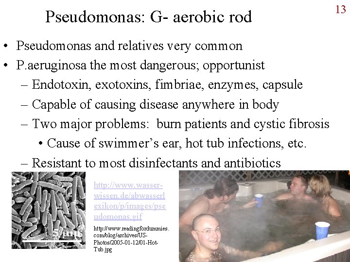 Pseudomonas: G- aerobic rod • Pseudomonas and relatives very common • P. aeruginosa the
