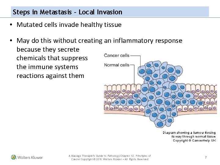 Steps in Metastasis – Local Invasion • Mutated cells invade healthy tissue • May