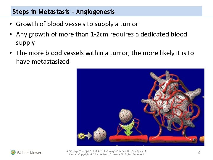 Steps in Metastasis – Angiogenesis • Growth of blood vessels to supply a tumor