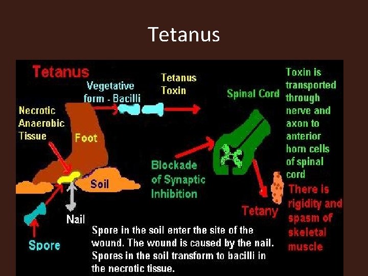 Tetanus 