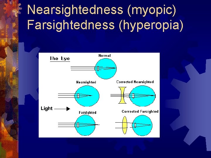 Nearsightedness (myopic) Farsightedness (hyperopia) 