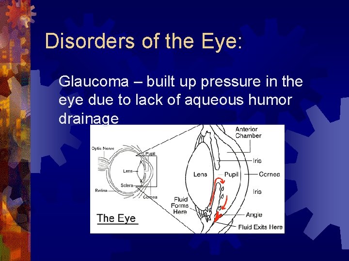 Disorders of the Eye: Glaucoma – built up pressure in the eye due to