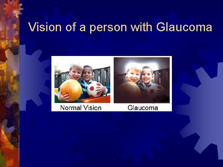 Vision of a person with Glaucoma 