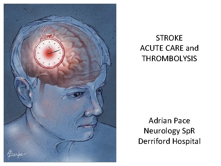 STROKE ACUTE CARE and THROMBOLYSIS Adrian Pace Neurology Sp. R Derriford Hospital 