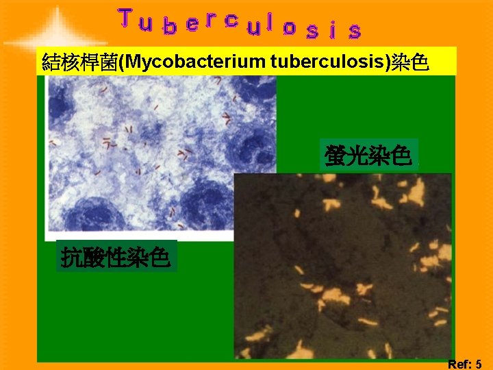 Understand 1 Virulence Factor Of Bacteria 2 Koch