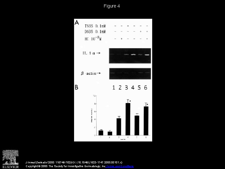 Figure 4 J Invest Dermatol 2000 115746 -752 DOI: (10. 1046/j. 1523 -1747. 2000.