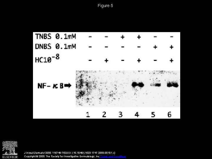 Figure 5 J Invest Dermatol 2000 115746 -752 DOI: (10. 1046/j. 1523 -1747. 2000.