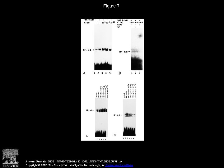 Figure 7 J Invest Dermatol 2000 115746 -752 DOI: (10. 1046/j. 1523 -1747. 2000.