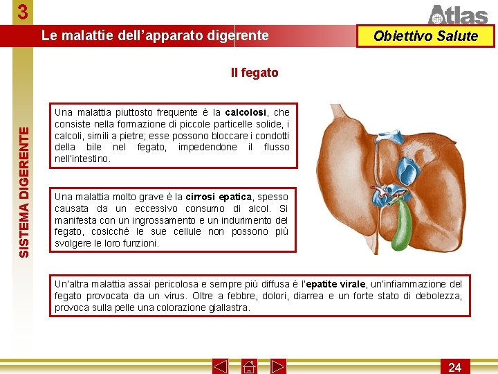 3 Le malattie dell’apparato digerente Obiettivo Salute SISTEMA DIGERENTE Il fegato Una malattia piuttosto