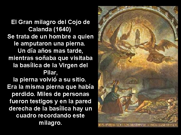 El Gran milagro del Cojo de Calanda (1640) Se trata de un hombre a