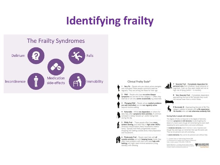 Identifying frailty 