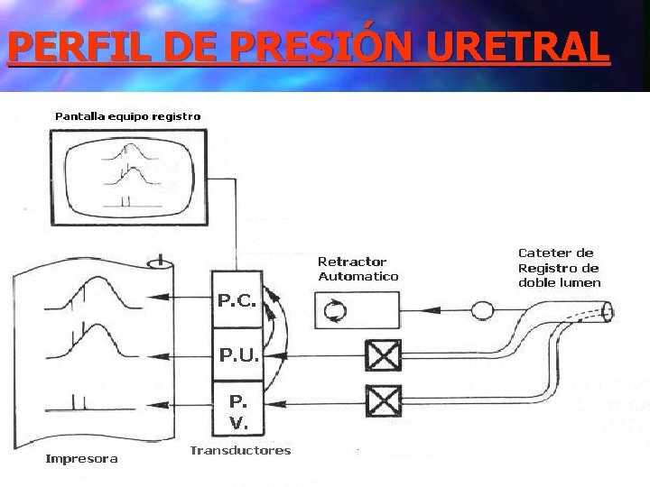PERFIL DE PRESIÓN URETRAL 