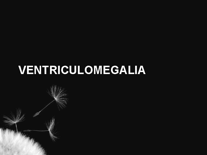 VENTRICULOMEGALIA 